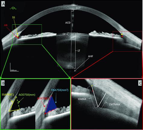 measuring corneal thickness with oct|oct for anterior segment imaging.